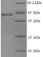 Human BEN domain-containing protein 3 (BEND3), partial Recombinant Protein, N-GST - BioCrest Sci