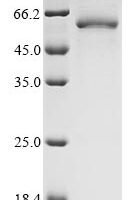 Human Leucine-rich repeat and immunoglobulin-like domain-containing nogo receptor-interacting protein 1 (LINGO1), partial Recombinant Protein - BioCrest Sci