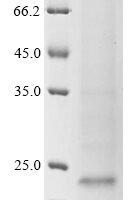 Hepatitis B virus genotype C subtype ayw Capsid protein (C) Recombinant Protein, Tag-Free - BioCrest Sci