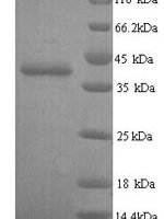 Human Talin-2 (TLN2), partial Recombinant Protein, N-His - BioCrest Sci
