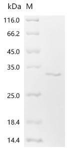 Mouse TAF15 RNA polymerase II, TATA box binding protein (TBP)-associated factor (Taf15), partial Recombinant Protein, Mus musculus (Mouse), E.coli, N-terminal 6xHis-Trx-tagged, 27.1 kDa, purity >≥ 95% as determined by SDS-PAGE.