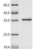 Human Transcriptional enhancer factor TEF-4 (TEAD2), partial Recombinant Protein, N-His/C-His - BioCrest Sci