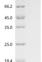 Phleum pratense Profilin-1 (PRO1) Recombinant Protein, N-His - BioCrest Sci