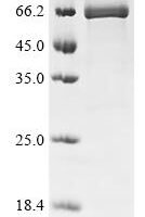Rat Alpha-fetoprotein (Afp) Recombinant Protein - BioCrest Sci
