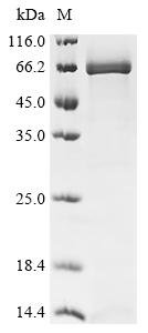 Rat Alpha-fetoprotein (Afp) Recombinant Protein, Rattus norvegicus (Rat), Yeast, C-terminal 6xHis-tagged, 67.2 kDa, purity >≥ 85% as determined by SDS-PAGE.