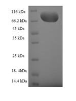 Human Guanine nucleotide-binding protein-like 3-like protein (GNL3L) Recombinant Protein, Homo sapiens (Human), E.coli, N-terminal 6xHis-SUMO-tagged, 81.6 kDa, purity >≥ 90% as determined by SDS-PAGE.