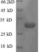Escherichia coli 50S ribosomal protein L36 (rpmJ) Recombinant Protein - BioCrest Sci