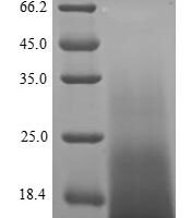 Parietaria judaica Probable non-specific lipid-transfer protein 2 Recombinant Protein - BioCrest Sci