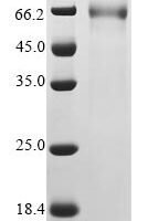 Human betacoronavirus 2c EMC/2012 Spike glycoprotein (S), partial Recombinant Protein, C-mFC - BioCrest Sci