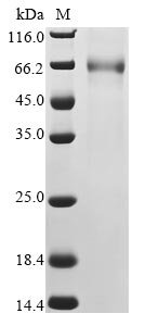 Human betacoronavirus 2c EMC/2012 Spike glycoprotein (S), partial Recombinant Protein, C-mFC, Human betacoronavirus 2c EMC/2012, Mammalian cell, C-terminal mFC-tagged, 55.6 kDa, purity >≥ 90% as determined by SDS-PAGE.