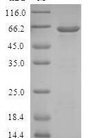 Human Aldo-keto reductase family 1 member C4 (AKR1C4) Recombinant Protein, N-GST - BioCrest Sci