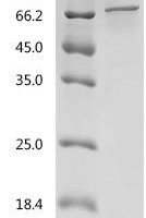 Enterobacteria phage T4 Portal protein (20) Recombinant Protein - BioCrest Sci