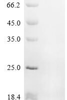 Human Nuclear factor NF-kappa-B p105 subunit (NFKB1) Recombinant Protein, C-His - BioCrest Sci