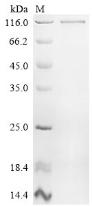 Human Nuclear factor NF-kappa-B p105 subunit (NFKB1) Recombinant Protein, C-His, Homo sapiens (Human), E.coli, C-terminal 6xHis-tagged, 112.3 kDa, purity >≥ 90% as determined by SDS-PAGE.