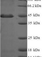 Human Proteasome inhibitor PI31 subunit (PSMF1) Recombinant Protein - BioCrest Sci