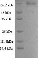Hepatitis C Genome polyprotein Recombinant Protein - BioCrest Sci