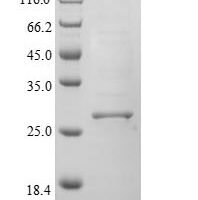Rat H-2 class II histocompatibility antigen gamma chain (Cd74), partial Recombinant Protein - BioCrest Sci