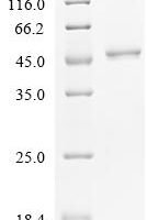 Human Hemoglobin subunit beta (HBB) Recombinant Protein - BioCrest Sci