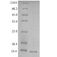 Human Lymphocyte antigen 6H (LY6H) Recombinant Protein - BioCrest Sci