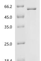 Mouse Matrix metalloproteinase-14 (Mmp14), partial Recombinant Protein - BioCrest Sci