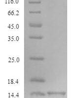 Xenopus laevis Transforming growth factor beta-1 (TGFB1) Recombinant Protein - BioCrest Sci