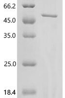 Mouse TSC22 domain family protein 4 (Tsc22d4) Recombinant Protein, N-His, aa 1–387, E.coli - BioCrest Sci