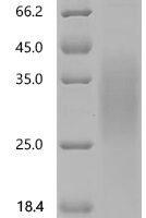 Human Synaptic vesicle glycoprotein 2C（SV2C), partial Recombinant Protein, C-10His - BioCrest Sci