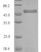 Bovine Pentraxin-related protein PTX3 (PTX3) Recombinant Protein - BioCrest Sci