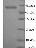 Human Glypican-6 (GPC6) Recombinant Protein, N-His - BioCrest Sci