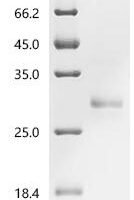Bovine Prolactin (PRL) Recombinant Protein, C-His, aa 31–229, Yeast - BioCrest Sci