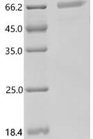 Human Interleukin-9 receptor (IL9R), partial Recombinant Protein - BioCrest Sci