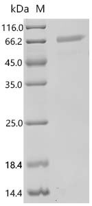 Human Interleukin-9 receptor (IL9R), partial Recombinant Protein, Homo sapiens (Human), Mammalian cell, C-terminal hFc1-tagged, 54.8 kDa, purity >≥ 95% as determined by SDS-PAGE.