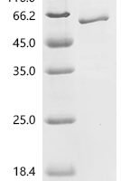 Human Egl nine homolog 1 (EGLN1) Recombinant Protein, C-His - BioCrest Sci
