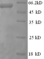 Human Eukaryotic translation initiation factor 4 gamma 1 (EIF4G1), partial Recombinant Protein, N-GST - BioCrest Sci