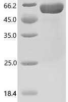 Human Tumor necrosis factor receptor superfamily member 11A (TNFRSF11A), partial Recombinant Protein - BioCrest Sci