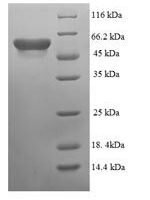 Escherichia coli Cytosine deaminase (codA) Recombinant Protein, N-His-SUMO - BioCrest Sci