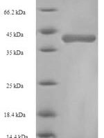 Rat Glutathione S-transferase alpha-1 (Gsta1) Recombinant Protein - BioCrest Sci