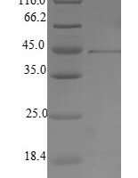 Human herpesvirus 2 Envelope glycoprotein B (gB),Partial Recombinant Protein - BioCrest Sci