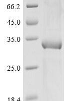 Mouse Protein IL-40 Recombinant Protein, N-10His/C-Myc - BioCrest Sci