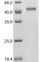 Human Galactose-1-phosphate uridylyltransferase (GALT) Recombinant Protein, N-His - BioCrest Sci