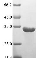 Human HLA class II histocompatibility antigen, DR alpha chain (HLA-DRA) Recombinant Protein - BioCrest Sci