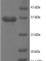 Human Platelet basic protein (PPBP), partial Recombinant Protein - BioCrest Sci
