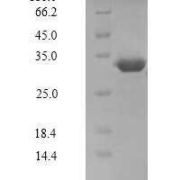 Human Serine/threonine-protein kinase PAK 5 (PAK5), partial Recombinant Protein, N-His - BioCrest Sci
