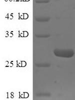 Saccharomyces cerevisiae TATA-box-binding protein (SPT15) Recombinant Protein, N-His, aa 2–240, E.coli - BioCrest Sci