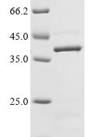 Human Muscarinic acetylcholine receptor M5 (CHRM5), partial Recombinant Protein - BioCrest Sci