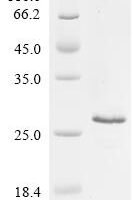 Human Osteopontin (SPP1), partial Recombinant Protein, C-His - BioCrest Sci