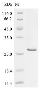 Human Osteopontin (SPP1), partial Recombinant Protein, C-His, Homo sapiens (Human), E.coli, C-terminal 6xHis-tagged, 17.8 kDa, purity >≥ 85% as determined by SDS-PAGE.