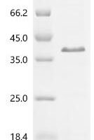 Mouse Microfibrillar-associated protein 2 (Mfap2) Recombinant Protein - BioCrest Sci