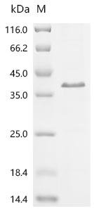 Mouse Microfibrillar-associated protein 2 (Mfap2) Recombinant Protein, Mus musculus (Mouse), E.coli, C-terminal 6xHis-tagged, 25.7 kDa, purity >≥ 85% as determined by SDS-PAGE.