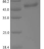 Human Cellular tumor antigen p53 (TP53) Recombinant Protein, N-His, aa 1–393, Yeast - BioCrest Sci